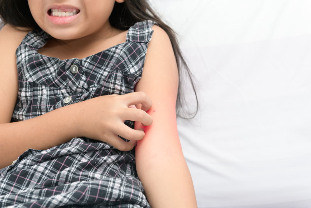 Symptoms and treatments for children with eczema.